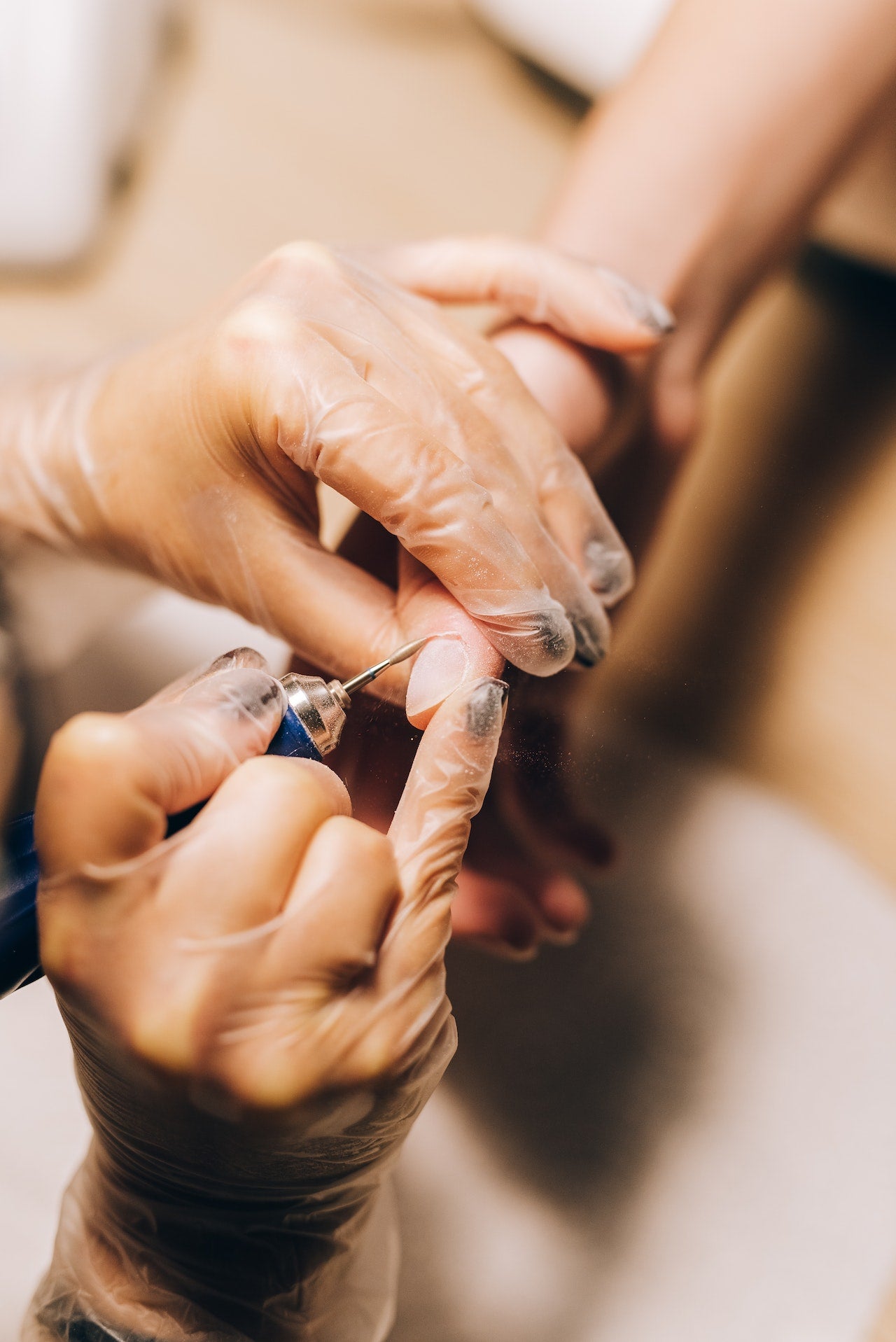 Schimmelnagels: de oorzaak ontdekt en hoe ze te voorkomen